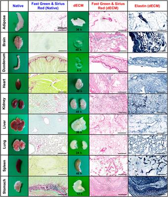 Pipeline for precise insoluble matrisome coverage in tissue extracellular matrices